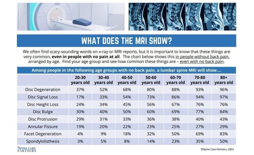 do you have arthritis or disc problems?