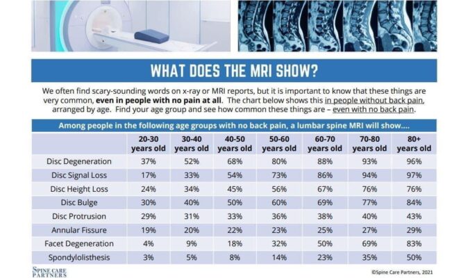 do you have arthritis or disc problems?